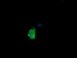 MDM4 / MDMX Antibody (clone OTI2C1)