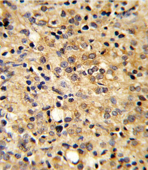 COMP / THBS5 Antibody (aa314-343)