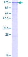 Human CDH1 / E Cadherin Protein (Recombinant GST)
