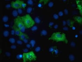 TBC1D4 / AS160 Antibody (clone OTI5E6)