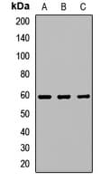 Polyclonal Rabbit anti-Human IL21 Receptor Antibody (WB)