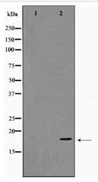 Polyclonal Rabbit anti-Human SNCA / Alpha-Synuclein Antibody (WB)
