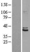 POLDIP2 / PDIP38 Protein (Over-Expression Lysate Myc-DDK (Flag))