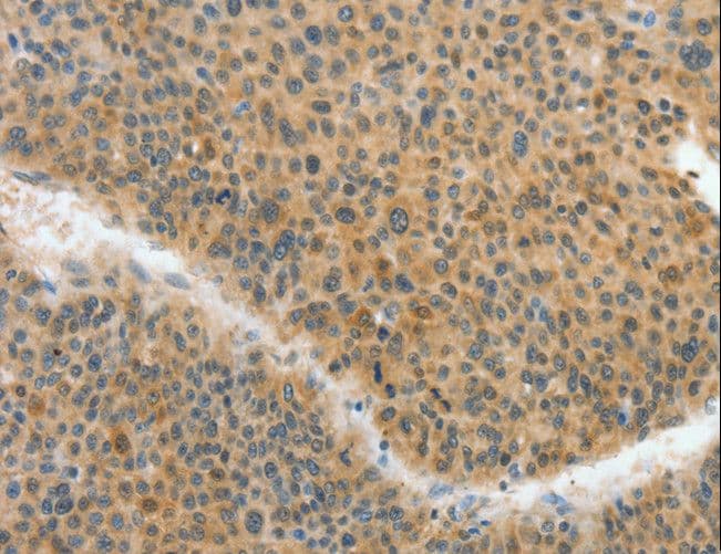 ACLY / ATP Citrate Lyase Antibody