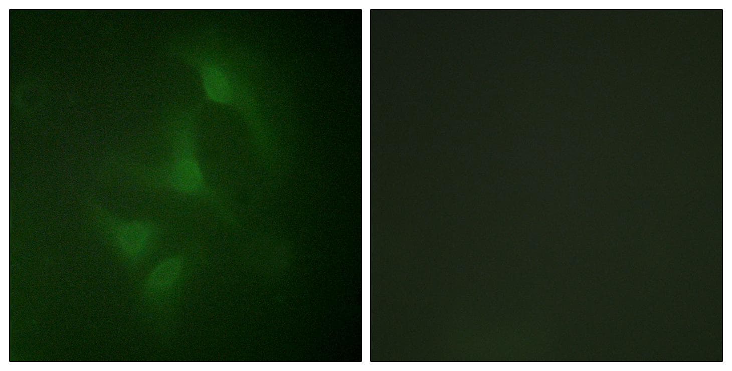 Polyclonal Rabbit anti-Human MAPK8 / JNK1 Antibody (Ab-183/185, IHC, IF, WB)