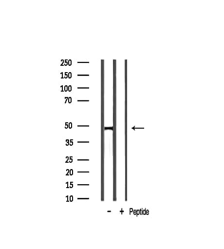 Polyclonal Rabbit anti-Human TGFB2 / TGF Beta2 Antibody (IHC, WB)