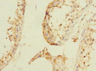 NPM2 Antibody