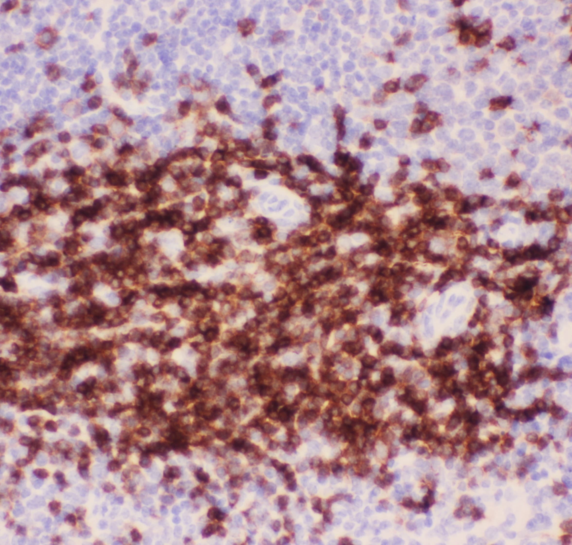 CD3E Antibody (aa23-207)