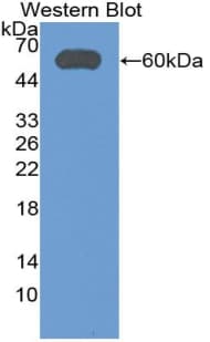 ALDH7A1 Antibody (aa1-539)