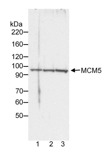 Polyclonal Rabbit anti-Human MCM5 Antibody (aa1-50, IHC, WB)