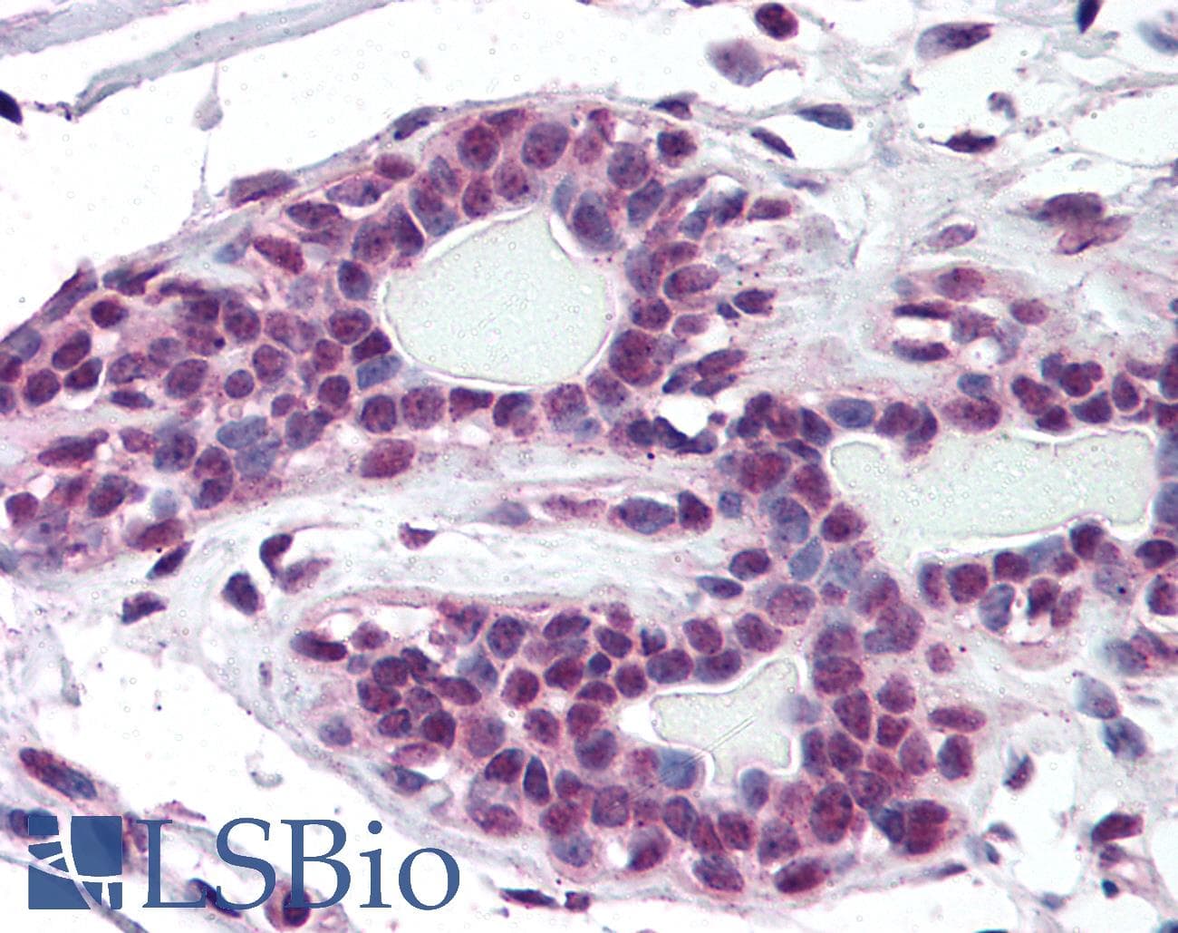 IHC-plus™ ZMYM2 / RAMP Antibody (aa1250-1300)