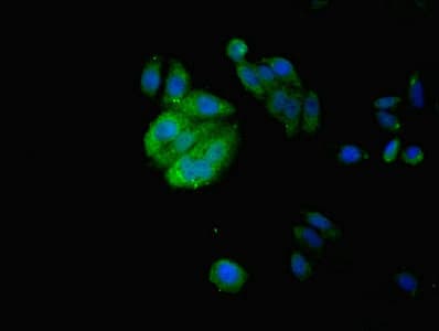 Polyclonal Rabbit anti-Human IZUMO4 Antibody (aa16-214, IHC, WB)