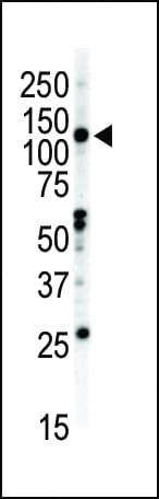 EPHB2 / EPH Receptor B2 Antibody (aa1021-1050)