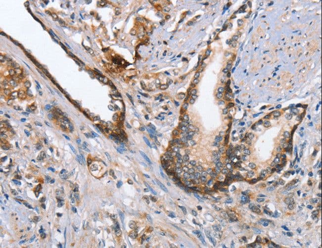 CMT2 / MAD2L1BP Antibody