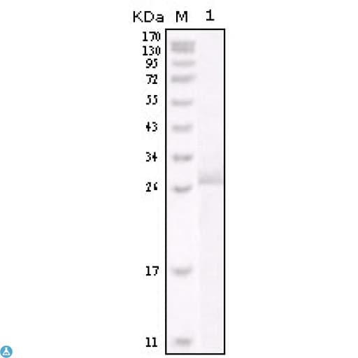 ERBB2 / HER2 Antibody
