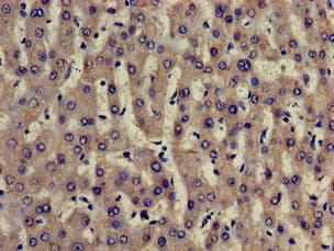 Polyclonal Rabbit anti-Human TRADD Antibody (IHC, IF, WB)
