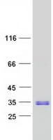 Human TGIF2 Protein (Recombinant Myc-DDK (Flag))