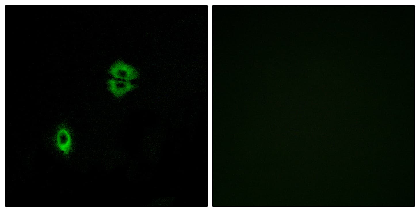 Polyclonal Rabbit anti-Human CCR7 Antibody (aa170-219, IF, WB)