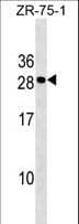 CLEC9A Antibody (aa146-173)