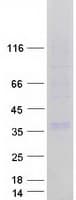 Human GJB3 / CX31 / Connexin 31 Protein (Recombinant Myc-DDK (Flag))