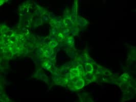 Monoclonal Mouse anti-Human p16INK4a / CDKN2A Antibody (clone OTI4C11, IF, WB)