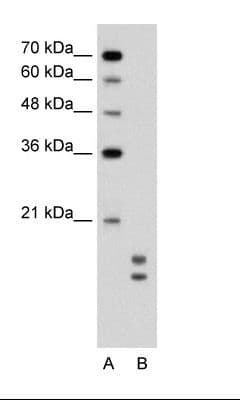 UBE2L3 / UBCH7 Antibody (C-Terminus)