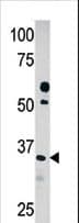 PDXK / PNK Antibody (aa242-272)