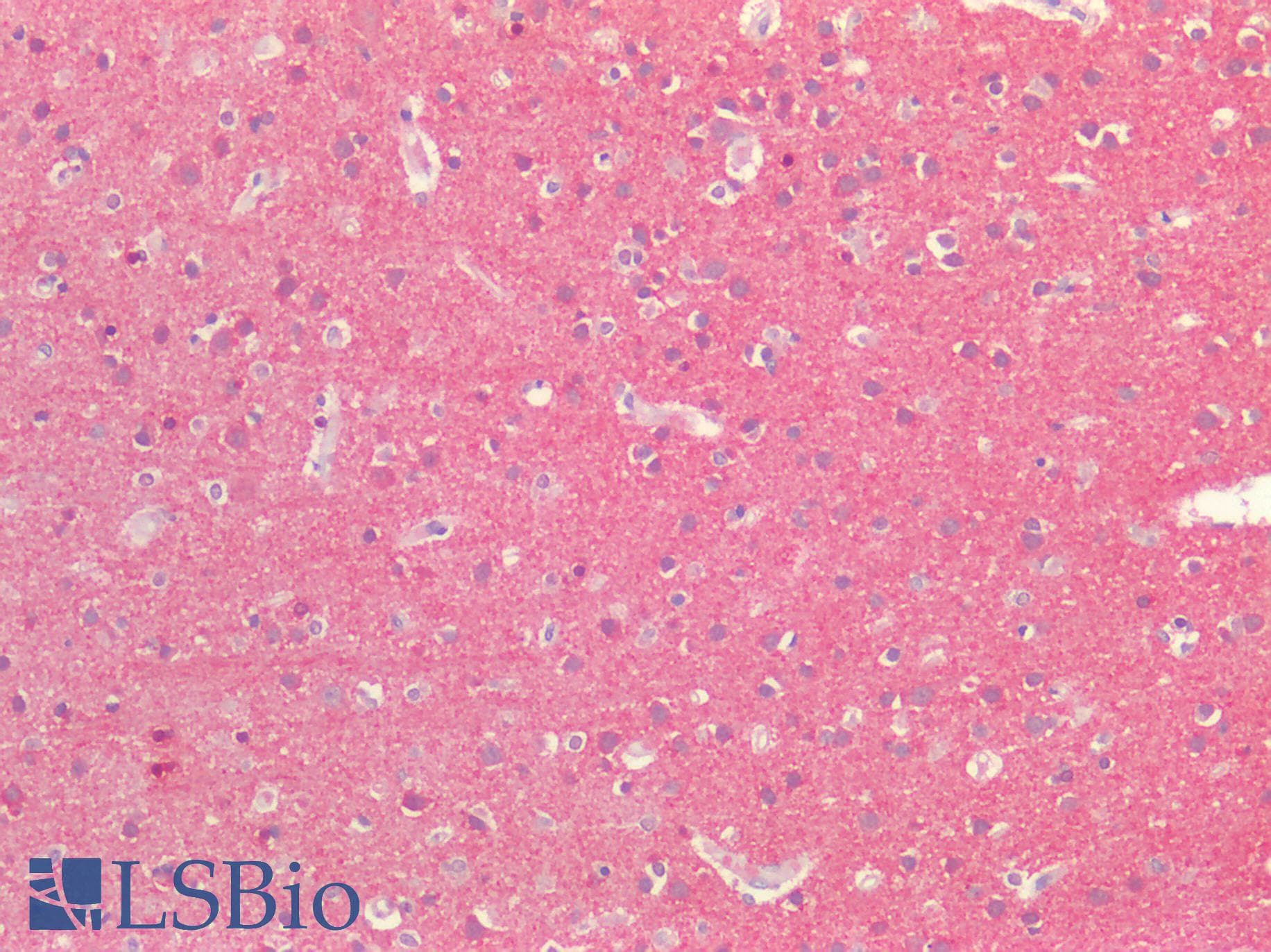 PathPlus™ Polyclonal Rabbit anti-Human MAPT / Tau Antibody (IHC, WB)
