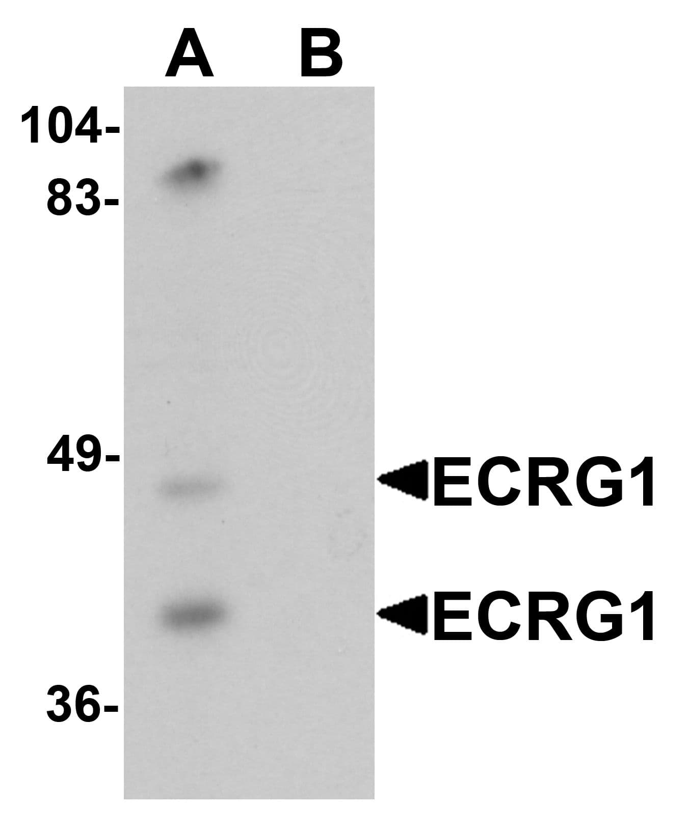 IHC-plus™ TMPRSS11A Antibody