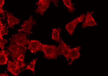 HNF1B / HNF1 Beta Antibody