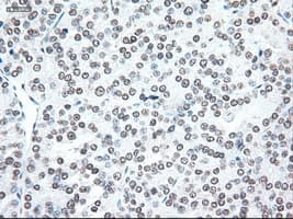 NOG / Noggin Antibody (clone OTI1C1)