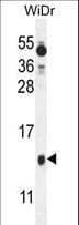 BEX1 Antibody (aa63-90)