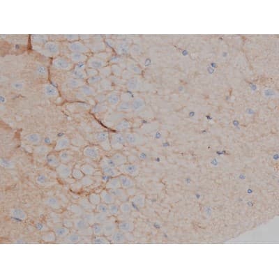 MAPT / Tau Antibody (phospho-Ser356)