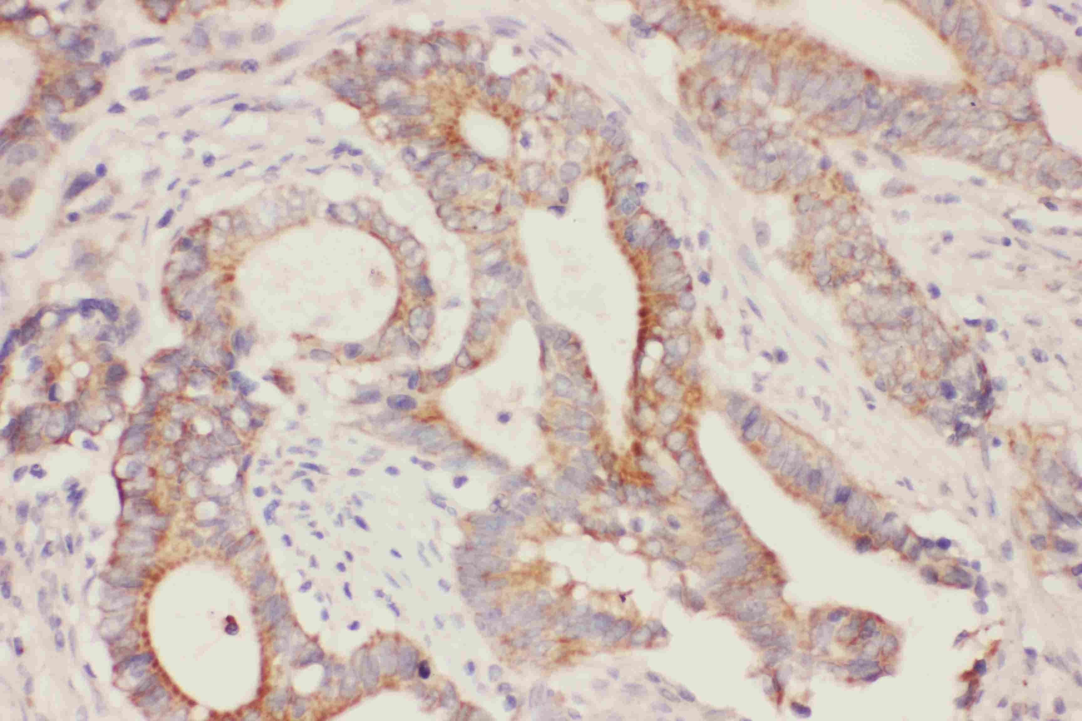 E-FABP / FABP5 Antibody (aa2-16)