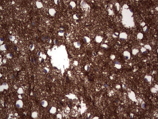 Monoclonal Mouse anti-Human NCAM / CD56 Antibody (clone OTI2A2, Carrier-free, aa20-718, IHC, WB)