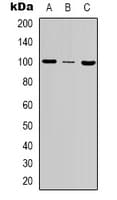 Polyclonal Rabbit anti-Human MSH2 Antibody (Internal, IHC, IF, WB)