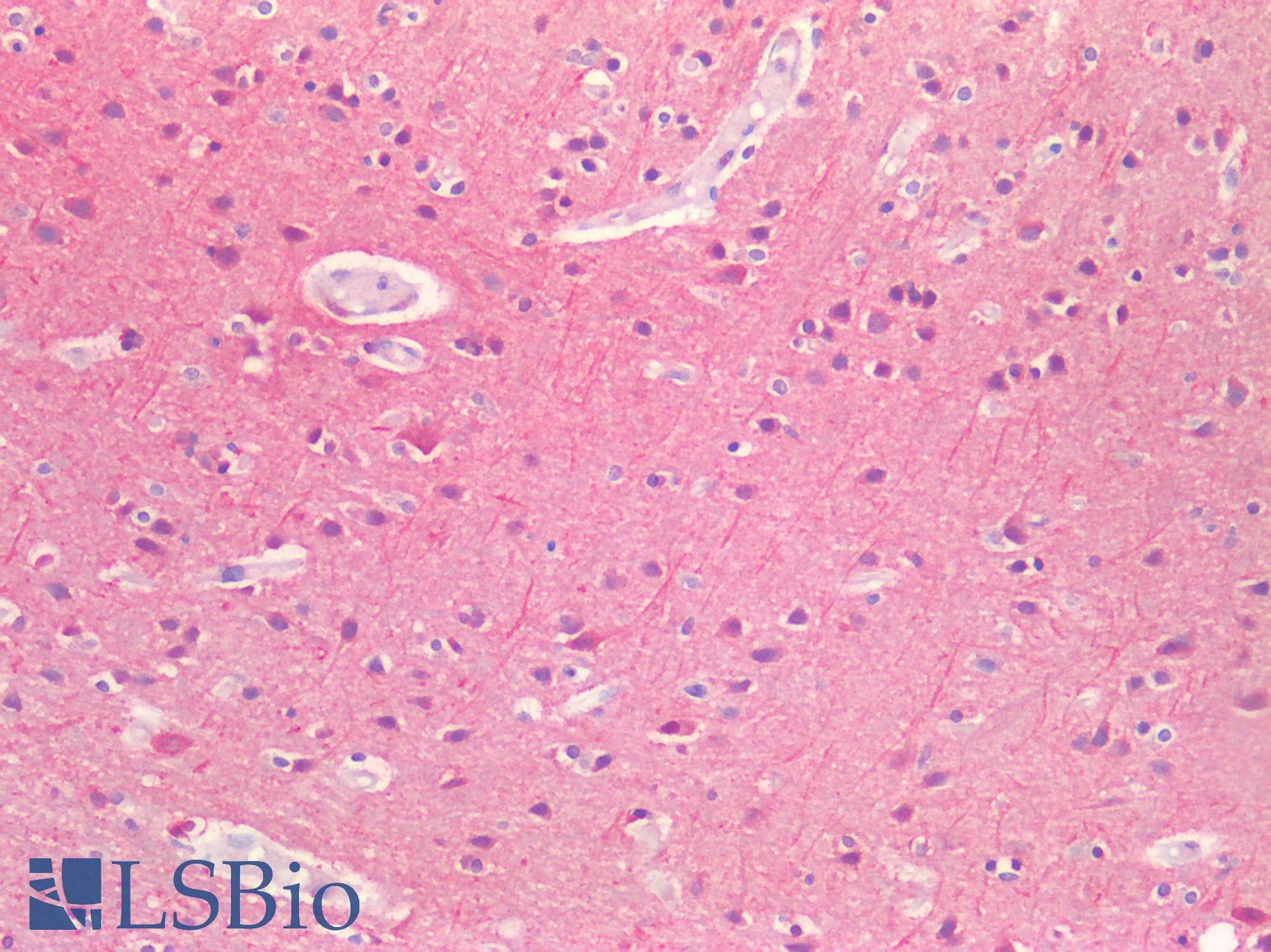 Polyclonal Rabbit anti-Human TUBB / Beta Tubulin Antibody (IHC, WB)