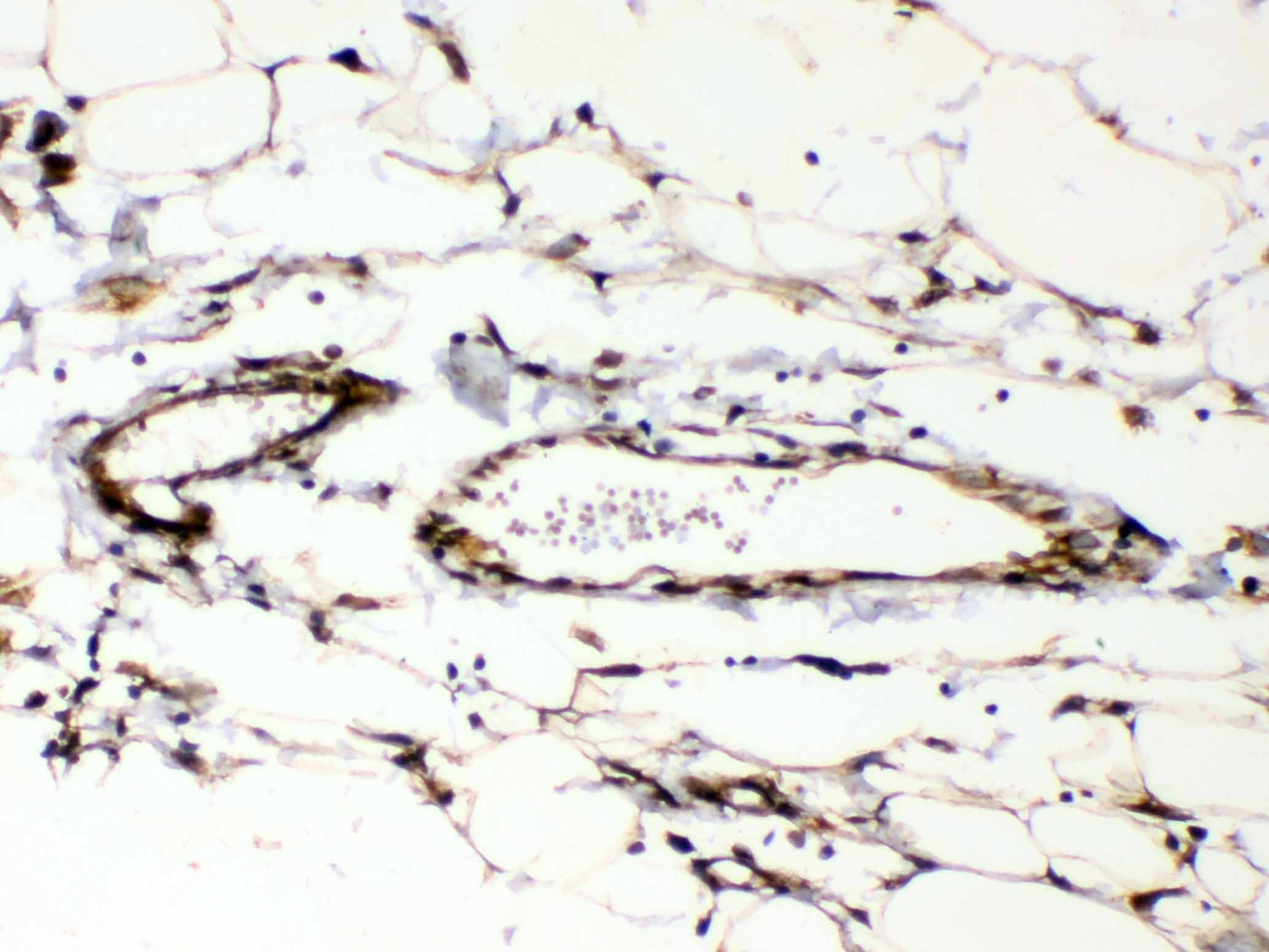 Polyclonal Rabbit anti-Human PPIB / Cyclophilin B Antibody (IHC, WB)