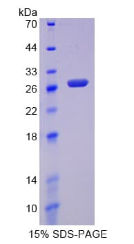 Human CDO1 / Cysteine Dioxygenase Protein (Recombinant His-T7)