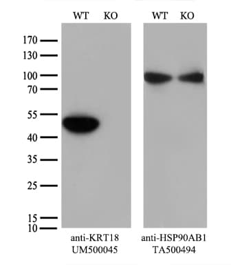 KRT18 / CK18 / Cytokeratin 18 Antibody (aa69-372, clone UMAB50)