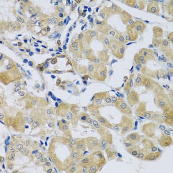 Polyclonal Rabbit anti-Human SYT11 Antibody (IHC, WB)