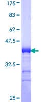 Human ADAMTS17 Protein (Recombinant GST, N-terminus)
