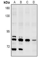 Polyclonal Rabbit anti-Human NEK5 Antibody (WB)