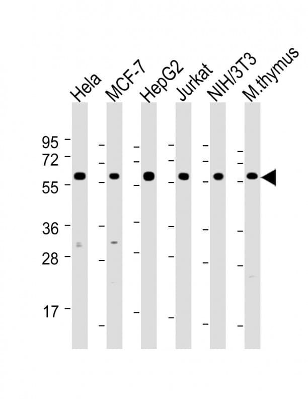 HSPD1 / HSP60 Antibody