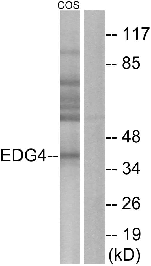 Polyclonal Rabbit anti-Human LPAR2 / EDG4 Antibody (aa271-320, IF, WB)