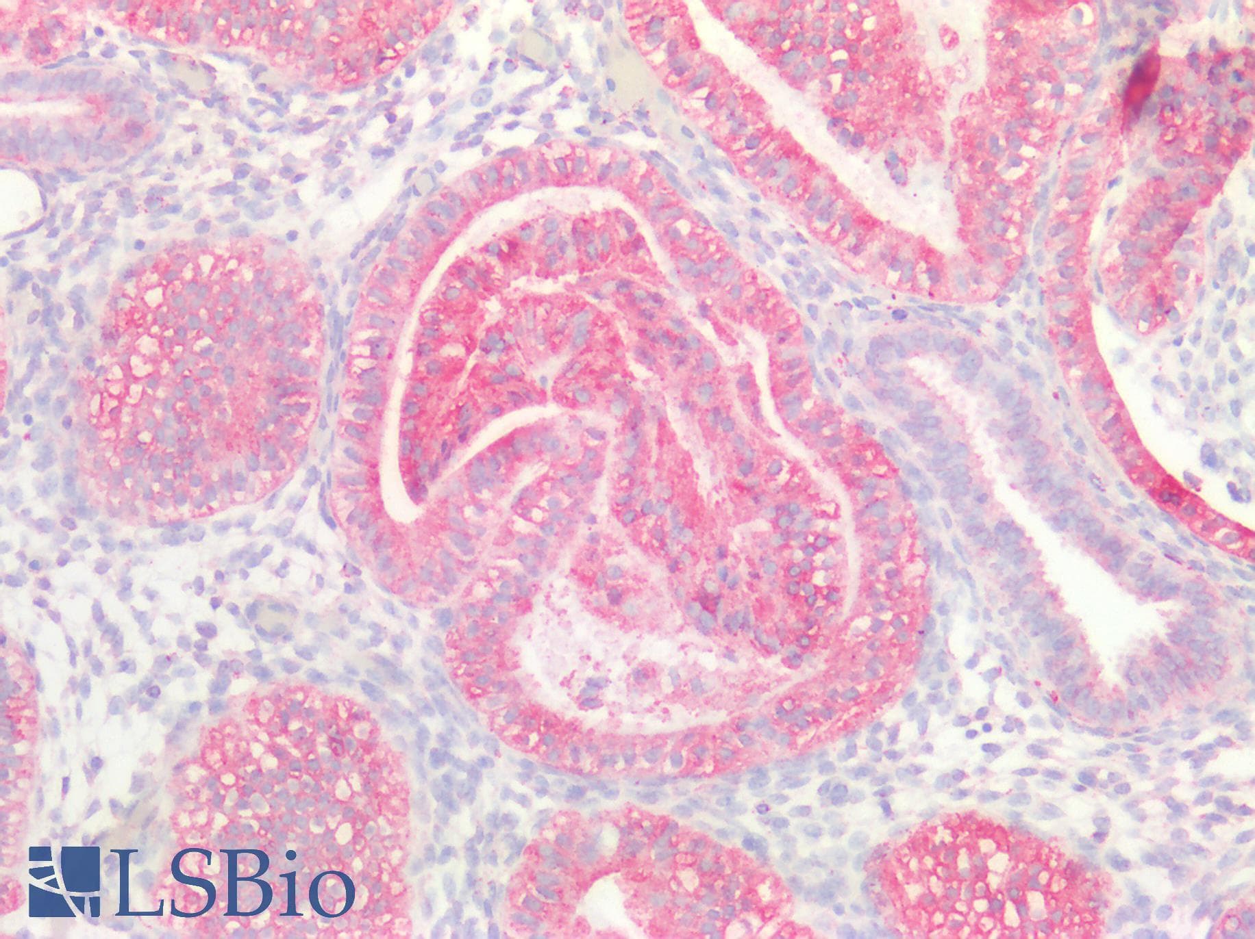 PathPlus™ CD47 Antibody
