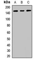 RBM6 / 3G2 Antibody