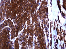 Monoclonal Mouse anti-Human TCL / RHOJ Antibody (clone OTI5F5, IHC, WB)
