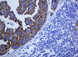 KRT5 / CK5 / Cytokeratin 5 Antibody (clone OTI4A7)