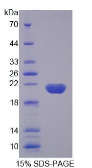 Human GREM2 / Gremlin 2 Protein (Recombinant His-T7)